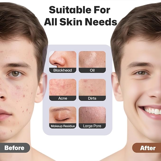 AquaDrip Rechargeable Silicone Facial Cleansing Brush – Deep Cleansing, Gentle Exfoliation & Heat Massage | Waterproof Face Scrubber for All Skin Types