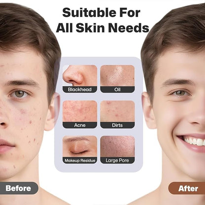 AquaDrip Rechargeable Silicone Facial Cleansing Brush – Deep Cleansing, Gentle Exfoliation & Heat Massage | Waterproof Face Scrubber for All Skin Types